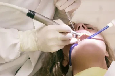 Cirugía dental